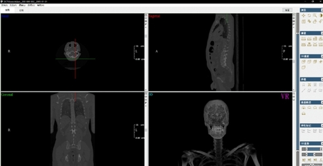 DCTViewer 開(kāi)啟醫(yī)學(xué)三維分析新視界